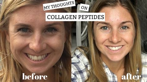 Prostaglandin in Lash Serums: Purity, Manufacturing, and Sourcing Guide for Cosmetic Formulators