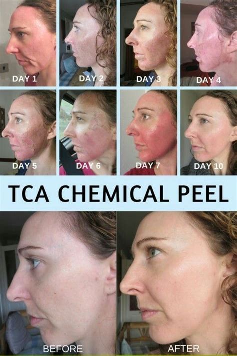 Top 5 Peptide Types for Skin: Tech Deep Dive & Selection Guide